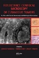 Reflectance Confocal Microscopy Of Cutaneous Tumors "An Atlas With Clinical, Dermoscopic And Histological Correl"