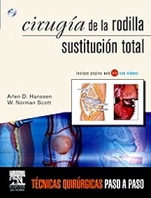 Cirugía de la Rodilla Sustitución Total "Incluye DVD-Rom"