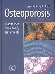 Osteoporosis "Diagnostico, Prevención y Tratamiento"