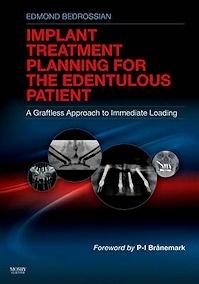 Implant Treatment Planning For The Edentulous Patient "A Graftless Approach To Immediate Loading"