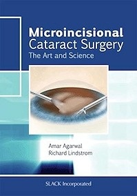 Microincisional Cataract Surgery "The Art And Science"