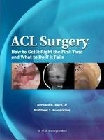 ACL Surgery "How to Get it Right the First Time and What to Do When Your Surgery Fail"