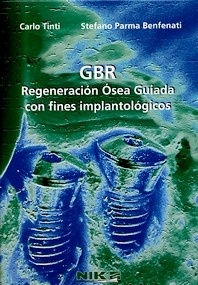 GBR Regeneración Osea Guiada con Fines Implantológicos