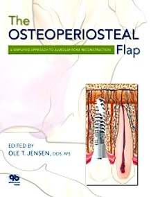The Osteoperiosteal Flap: A Simplified Approach to Alveolar Bone Reconstruction
