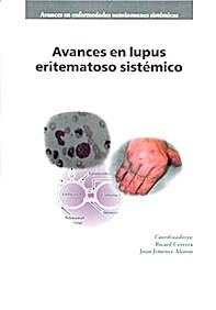 Avances en Lupus Eritematoso Sistémico