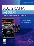 Ecografía Vascular + DVD-ROM "Cómo, Por Qué y Cuándo"