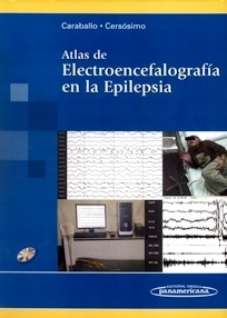 Atlas de Electroencefalografía en la Epilepsia