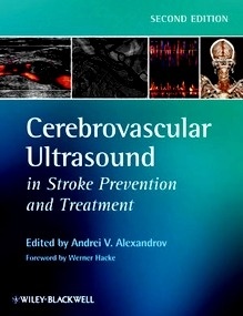 Cerebrovascular Ultrasound in Stroke Prevention and Treatment
