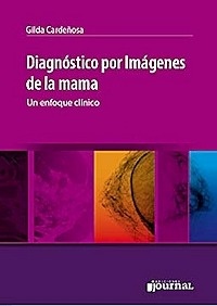 Diagnostico por Imagenes de la Mama. un Enfoque Clínico
