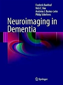 Neuroimaging In Dementia