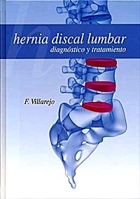 Hernia Discal Lumbar: Diagnóstico y Tratamiento
