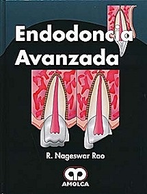 Endodoncia Avanzada