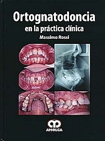 Ortognatodoncia en la Practica Clínica