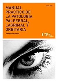 Manual Practico de la Patologia Palpebral, Lagrimal y Orbitaria