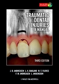 Traumatic Dental Injuries: A Manual