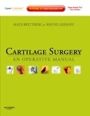 Cartilage Surgery "An Operative Manual"