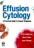 Effusion Cytology "A Practical Guide To Cancer Diagnosis"