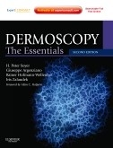 Dermoscopy "The Essentials"