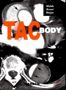 TAC Body de Residente