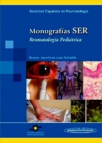 Reumatología Pediátrica "Monografías SER"