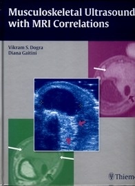 Musculoeskeletal Ultrasound With MRI Correlations