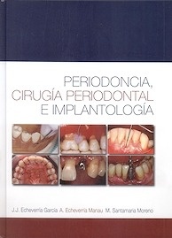 Periodoncia , Cirugía Periodontal E Implantología