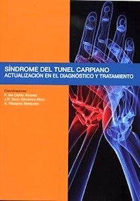 Síndrome del Tunel Carpiano "Actualización en el Diagnóstico y Tratamiento"