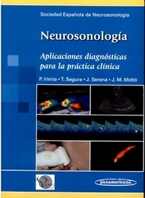 Neurosonología "Aplicaciones Diagnósticas para la Práctica"