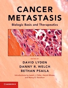 Cancer Metastasis "Biologic Basis and Therapeutics"