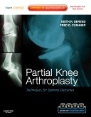 Partial Knee Arthroplasty "Techniques for Optimal Outcomes with DVD"