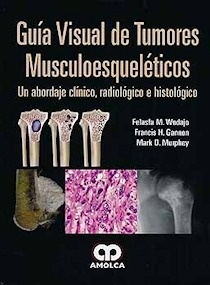 Guia Visual de Tumores Musculoesqueleticos "Un Abordaje Clínico, Radiológico e Histológico"