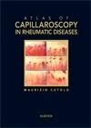 Atlas of Capillaroscopy in Rheumatic Diseases
