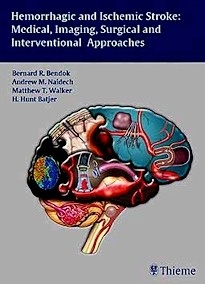 Hemorrhagic And Ischemic Stroke "Medical, Imaging, Surgical And Interventional Approaches"