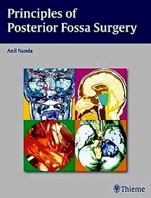 Principles Of Posterior Fossa Surgery