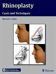 Rhinoplasty, Cases And Techniques