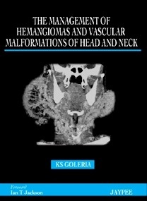 The Management of Haemangioma and Vascular Malformations of the Head and Neck