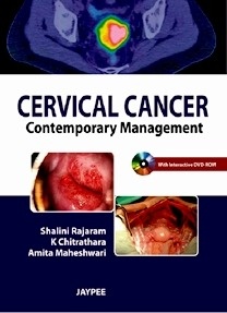 Cervical Cancer "Contemporary Management"