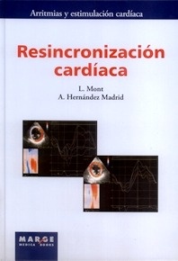 Resincronización Cardíaca
