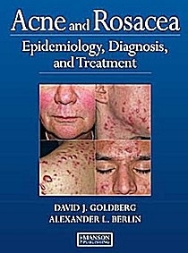 Acne, Rosacea & Other Facial Dermatoses "Current Diagnosis and Treatment"