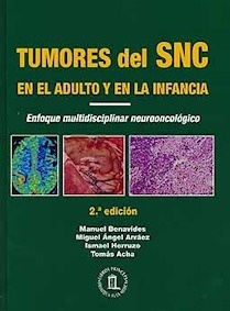 Tumores del Sistema Nervioso Central en el Adulto y en la Infancia "Enfoque Multidisciplinar Neurooncologico"