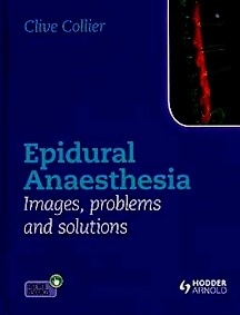 Epidural Anaesthesia: Images, Problems And Solutions
