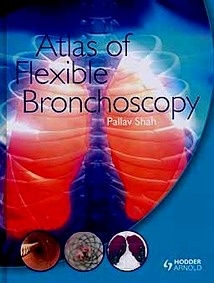 Atlas Of Flexible Bronchoscopy
