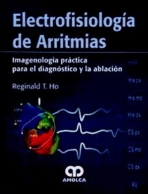 Electrofisiologia de Arritmias "Imageneologia Practica para el Diagnostico y la Ablacion"