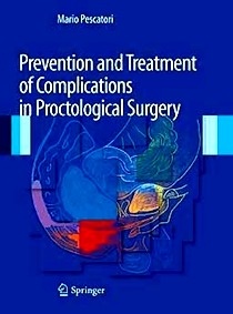 Prevention And Treatment Of Complications In Proctological Surgery