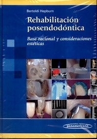 Rehabilitación Posendodóntica "Base Racional y Consideraciones Estéticas"