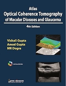 Atlas Optical Coherence Tomography of Macular Diseases and Glaucoma "Incluye DVD"
