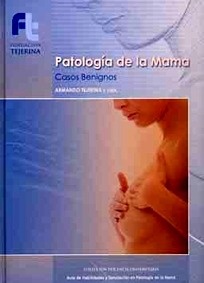Patologia de la Mama "Casos Benignos"
