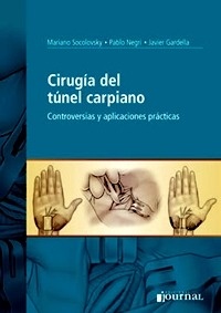 Cirugia del Tunel Carpiano "Controversias y Aplicaciones Practicas"
