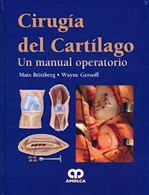 Cirugia del Cartilago. un Manual Operatorio