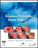 The Keystone Perforator Island Flap Concept